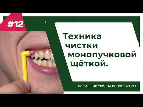 Видео: Техника чистки монопучковой щёткой. Урок №12 - ДОМАШНИЙ УХОД ЗА ПОЛОСТЬЮ РТА.