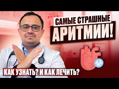 Видео: Самые опасные аритмии! Как распознать? Как лечить перебои в работе сердца.