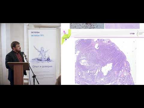 Видео: Абрамов Д. С. Первичные иммунодефициты: взгляд патолога