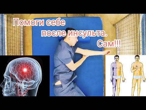 Видео: Гимнастика после инсульта - ЛФК в домашних условиях при гемипарезе