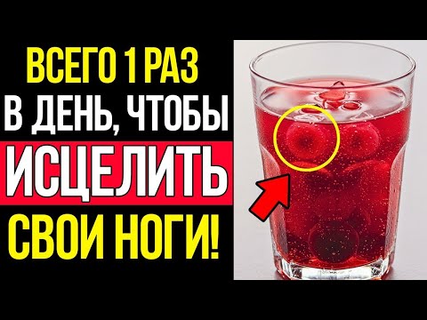 Видео: 146 Напиток №1 Для Избавления От Артрита И Улучшения Кровообращения В Ногах И Стопах!