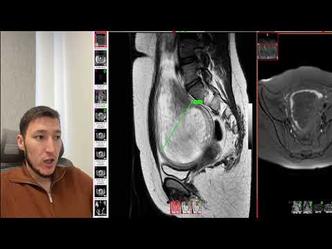 Видео: Про мрт режимы и сигналы.