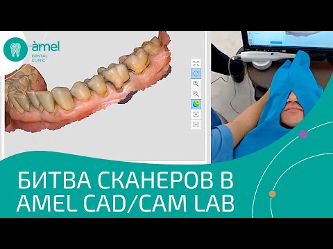 Видео: Битва сканеров в Bauers CAD/CAM Lab | Bauers Dental Store