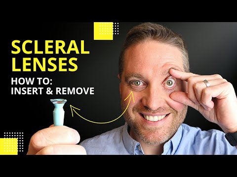 Видео: Установка и снятие склеральных линз: профессиональные советы для начинающих!