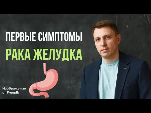 Видео: Первые симптомы рака желудка