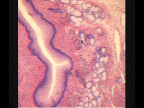 Видео: ПИЩЕВОД. OESOPHAGUS. В световой микроскоп.