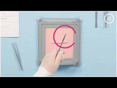 Видео: Закрытие раны