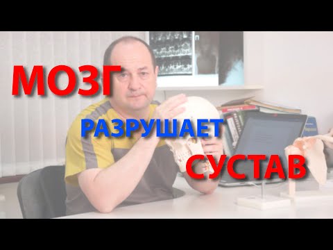 Видео: Мозг. Суставы. Психосоматика.