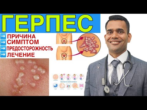 Видео: Попробуйте Это, Если Вас Беспокоит Герпес - Доктор Вивек Джоши