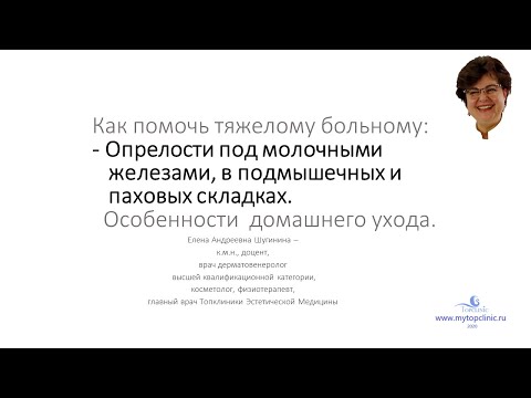 Видео: Опрелости под молочными железами и в паховой области
