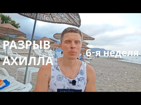 Видео: Разрыв ахилла. 6 неделя