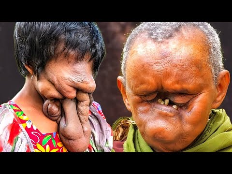 Видео: 10 самых редких женщин в мире с уникальными физическими особенностями.