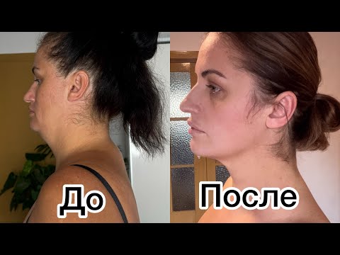 Видео: Челлендж 30 дней. Убираю второй подбородок. Подтягиваю овал лица. День 1.