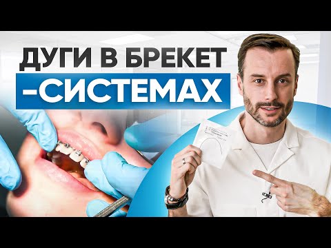 Видео: Дуги в брекет-системах: виды, цены, установка. Современная ортодонтия