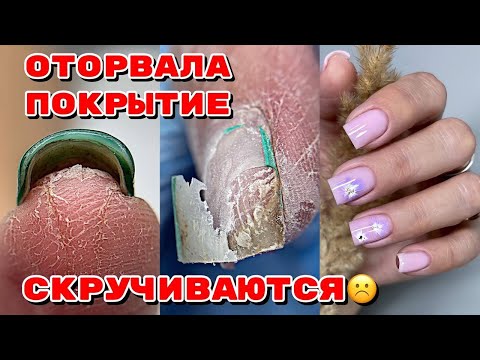 Видео: Скрученные ногти 😐 Оторванное покрытие 💅 Маникюр на квадрат