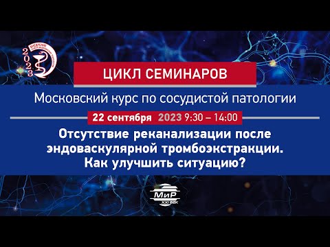 Видео: Лукьянов Андрей Львович Ишемический инсульт + ГТ