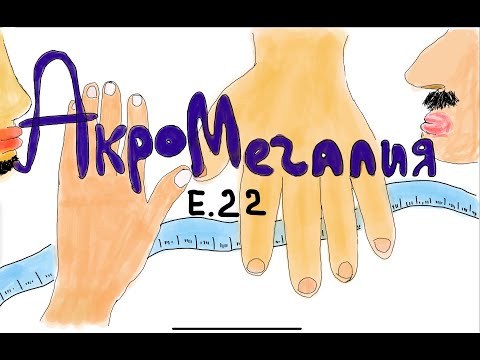 Видео: АКРОМЕГАЛИЯ- ЭТИОЛОГИЯ, ПАТОГЕНЕЗ, КЛИНИЧЕСКАЯ КАРТИНА.