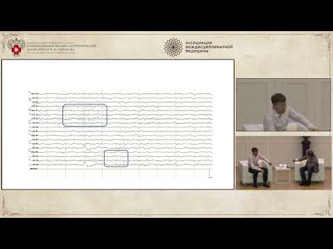 Видео: ЭПИЛЕПСИЯ 2023, Дело 6: Трагедия в трех актах