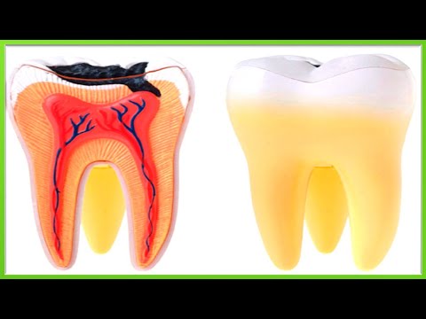 Видео: Биопломба в домашних условиях. Аир + прополис для здоровья зубов 😁 (teeth).