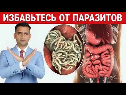 Видео: 3 СОВЕТА, КАК ИЗБАВИТЬСЯ ОТ ПАРАЗИТОВ.
