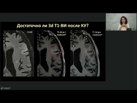 Видео: Вебинар МРО РОРР: "Планирование постконтрастного сбора данных в нейрорадиологии". Трофименко Ирина