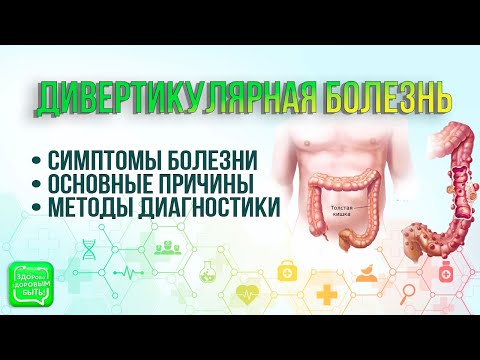 Видео: Основные причины дивертикулярной болезни