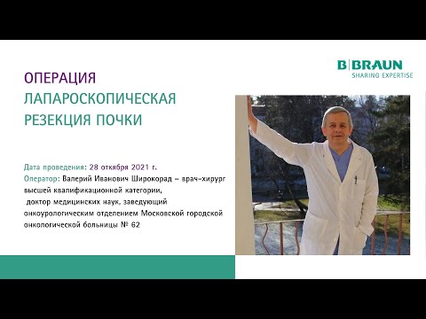 Видео: Лапароскопическая резекция почки №1 | Курс по онкоурологии | В.И. Широкорад