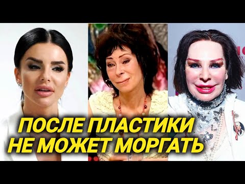 Видео: Кто эти люди? Узнать их сегодня трудно. Шокирующие кадры до и после пластики звезд