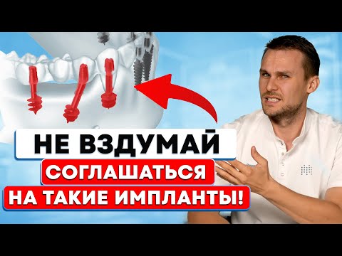 Видео: НИКОГДА НЕ СТАВЬ ТАКИЕ ИМПЛАНТЫ – Как выбрать ЛУЧШИЙ ИМПЛАНТ в 2026 году?