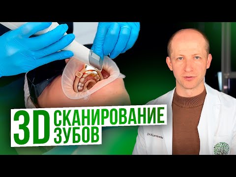 Видео: 3D СКАНИРОВАНИЕ ЗУБОВ / ЧТО И ДЛЯ ЧЕГО ЭТО?