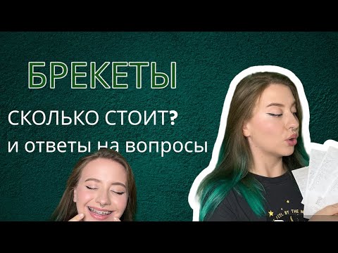 Видео: БРЕКЕТЫ Ч2 | отвечаю на вопросы о брекетах | сколько стоят брекеты?