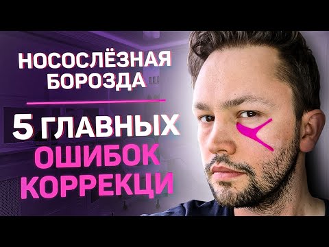 Видео: Мешки под глазами/Ошибки коррекции носослезной борозды.