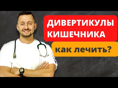 Видео: Дивертикулы кишечника. Диагностика и лечение