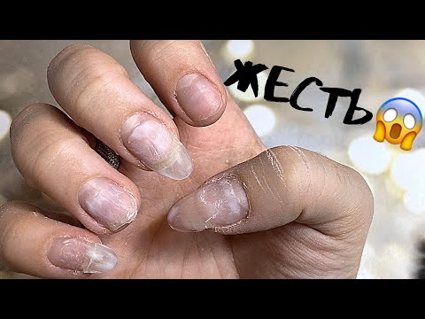 Видео: Прямой эфир | Коррекция ногтей| Сама себе мастер| Маникюр левой рукой|Gel nails|Yourself master