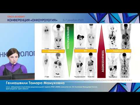 Видео: ПСМА-таргетная радионуклидная терапия метаст.кастрационно-резистентного РПЖ. Гелиашвили Т. М.