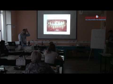 Видео: РКР4   Хабиев Камиль - Что такое композитное отбеливание