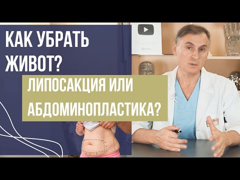 Видео: КАК УБРАТЬ ЖИВОТ? ЛИПОСАКЦИЯ ИЛИ АБДОМИНОПЛАСТИКА?