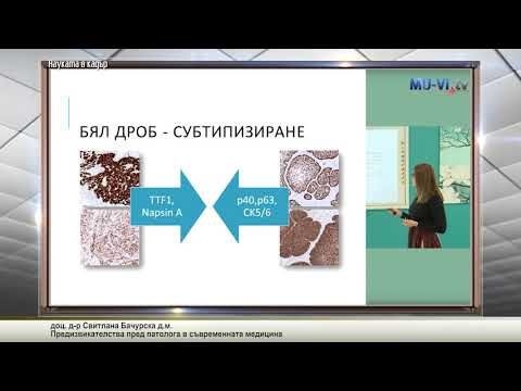 Видео: Предизвикателства пред патолога в съвременната медицина