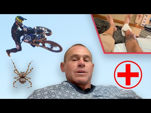 Видео: Я чуть не потерял ногу