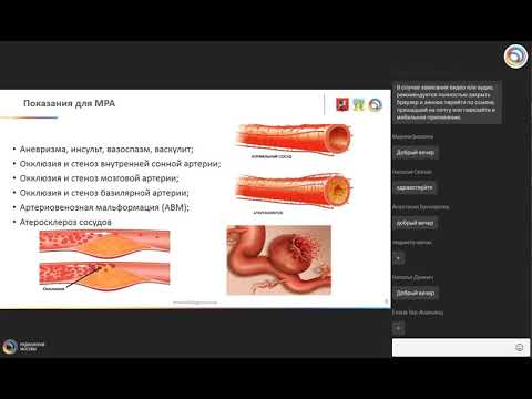 Видео: Технологии ангиографических исследований