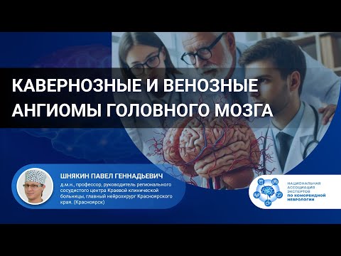Видео: Кавернозные ангиомы и венозные ангиомы головного мозга. Симптоматика и тактика ведения пациентов