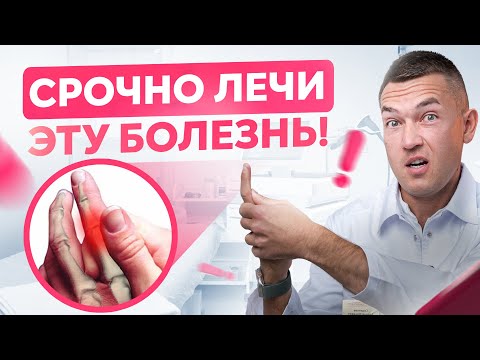 Видео: Щелкающий палец НУЖНО лечить! Что делать если пальцы не разгибаются? Болезнь Нотта