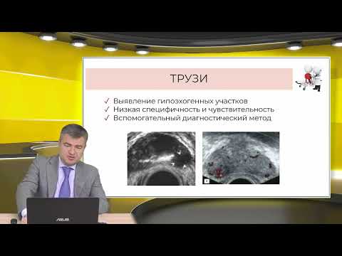 Видео: Рак предстательной железы диагностика, методы лечения