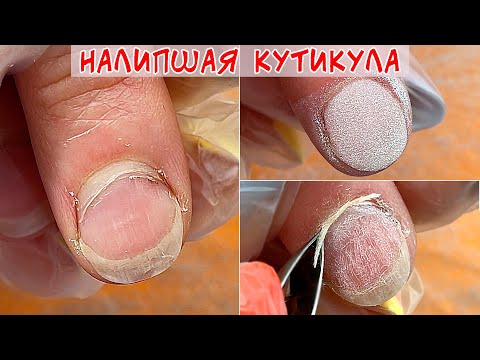 Видео: Налипшая кутикула / Аллергия на гель лак / Дип система для ногтей