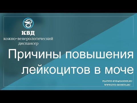 Видео: 80  Причины повышения лейкоцитов в моче