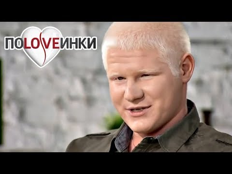 Видео: Человек АЛЬБИНОС ► Половинки ► Альбинос ► #1