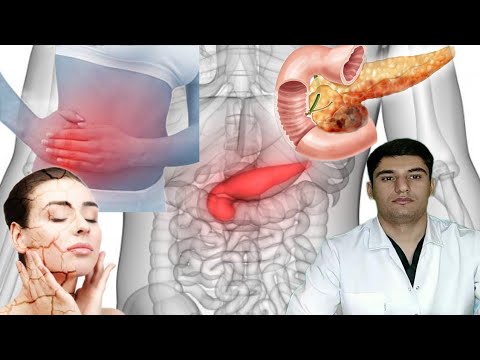 Видео: Панкреатит (Илтиҳоби  ғадуди зери меъда).#доктор#Лоиқ#бохтар#душанбе#помир#хучанд#бемор#табиб#мактаб