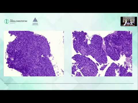 Видео: Представление клинического случая. г. Архангельск.