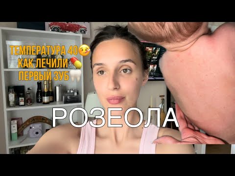 Видео: РОЗЕОЛА| ТЕМПЕРАУТРА 40| | ЛЕЧЕНИЕ РОЗЕОЛЫ| ПЕРВЫЙ ЗУБ| ПЕРВЫЙ СЕДОЙ ВОЛОС👵🏻