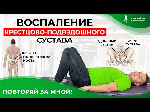 Видео: ТОП-3 упражнения при воспалении подвздошно-крестцового сустава. Кинезитерапия